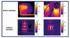 thermographie